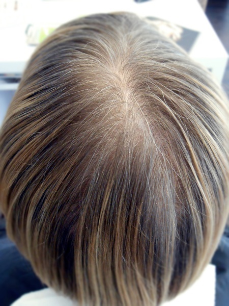 Frisuren für feines dünnes haar vorher nachher frisuren-fur-feines-dunnes-haar-vorher-nachher-73_13